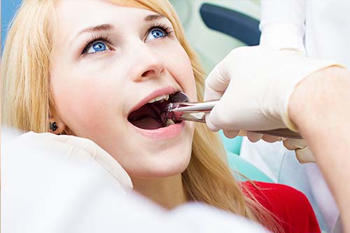 wisdom tooth extractions bentleigh